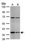 E3 ubiquitin-protein ligase CHIP antibody, GTX109676, GeneTex, Western Blot image 