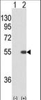 Serine/Threonine Kinase 40 antibody, LS-C161569, Lifespan Biosciences, Western Blot image 
