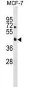 Reticulon 4 Receptor Like 2 antibody, abx029942, Abbexa, Western Blot image 