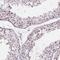 Zinc Finger Protein 572 antibody, NBP2-39077, Novus Biologicals, Immunohistochemistry paraffin image 
