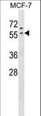 Zinc Finger Protein 383 antibody, LS-C157449, Lifespan Biosciences, Western Blot image 