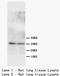 Aquaporin 5 antibody, orb18135, Biorbyt, Western Blot image 
