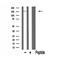 PHIP antibody, GTX00653, GeneTex, Western Blot image 