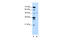 Tyrosinase Related Protein 1 antibody, 29-982, ProSci, Western Blot image 