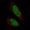 Chromosome 11 Open Reading Frame 71 antibody, NBP2-57761, Novus Biologicals, Immunocytochemistry image 