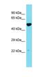 Leucine Rich Repeat Containing 74A antibody, orb326872, Biorbyt, Western Blot image 