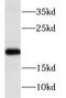 N(Alpha)-Acetyltransferase 50, NatE Catalytic Subunit antibody, FNab05563, FineTest, Western Blot image 