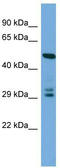 Defective In Cullin Neddylation 1 Domain Containing 4 antibody, TA334980, Origene, Western Blot image 