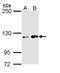 Homeodomain-interacting protein kinase 1 antibody, NBP1-33658, Novus Biologicals, Western Blot image 