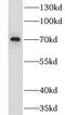 ClpB Homolog, Mitochondrial AAA ATPase Chaperonin antibody, FNab01771, FineTest, Western Blot image 