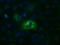 Aldehyde Dehydrogenase 1 Family Member L1 antibody, LS-B12234, Lifespan Biosciences, Immunofluorescence image 