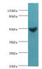 Dual specificity mitogen-activated protein kinase kinase 5 antibody, MBS1493796, MyBioSource, Western Blot image 