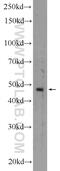 Keratin 40 antibody, 25398-1-AP, Proteintech Group, Western Blot image 