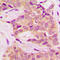 BCR Activator Of RhoGEF And GTPase antibody, LS-C358919, Lifespan Biosciences, Immunohistochemistry paraffin image 