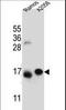 Eukaryotic Translation Initiation Factor 5A Like 1 antibody, LS-C167716, Lifespan Biosciences, Western Blot image 