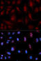 Phospholipase C Beta 1 antibody, A02817, Boster Biological Technology, Western Blot image 