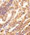 DIP antibody, M14911, Boster Biological Technology, Immunohistochemistry paraffin image 