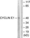 Cyclin E1 antibody, TA311854, Origene, Western Blot image 