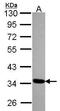 Translocase Of Outer Mitochondrial Membrane 34 antibody, GTX116439, GeneTex, Western Blot image 