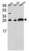 Rho GDP-dissociation inhibitor 1 antibody, AP17127PU-N, Origene, Western Blot image 