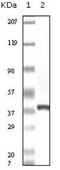 S100 Calcium Binding Protein A6 antibody, NB100-1765, Novus Biologicals, Western Blot image 