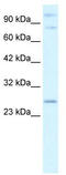 Polycomb group RING finger protein 3 antibody, TA335694, Origene, Western Blot image 