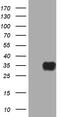 Ribonuclease A Family Member 11 (Inactive) antibody, M17007, Boster Biological Technology, Western Blot image 
