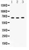 Solute Carrier Family 19 Member 1 antibody, PA5-80009, Invitrogen Antibodies, Western Blot image 