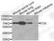 Fos Proto-Oncogene, AP-1 Transcription Factor Subunit antibody, A0236, ABclonal Technology, Western Blot image 