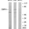 Protein DBF4 homolog A antibody, A01348-1, Boster Biological Technology, Western Blot image 