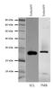 Green fluorescent protein 2 antibody, PA5-22688, Invitrogen Antibodies, Western Blot image 