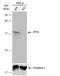 6-Pyruvoyltetrahydropterin Synthase antibody, NBP1-32975, Novus Biologicals, Western Blot image 