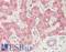 Insulin receptor substrate 2 antibody, LS-B14910, Lifespan Biosciences, Immunohistochemistry paraffin image 