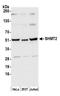 Serine Hydroxymethyltransferase 2 antibody, A305-350A, Bethyl Labs, Western Blot image 