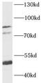 Small conductance calcium-activated potassium channel protein 3 antibody, FNab04497, FineTest, Western Blot image 
