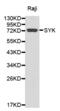 Spleen Associated Tyrosine Kinase antibody, AHP2529, Bio-Rad (formerly AbD Serotec) , Western Blot image 
