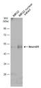Neuronal Differentiation 1 antibody, GTX134069, GeneTex, Western Blot image 