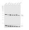 Lysophospholipase 2 antibody, PA5-27653, Invitrogen Antibodies, Western Blot image 