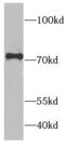 Raf-1 Proto-Oncogene, Serine/Threonine Kinase antibody, FNab07087, FineTest, Western Blot image 
