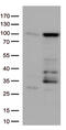 EWS RNA Binding Protein 1 antibody, CF813053, Origene, Western Blot image 