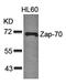 Zeta Chain Of T Cell Receptor Associated Protein Kinase 70 antibody, orb14568, Biorbyt, Western Blot image 
