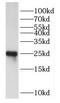 Dual Specificity Phosphatase 19 antibody, FNab02566, FineTest, Western Blot image 