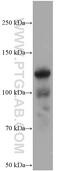 Cartilage oligomeric matrix protein antibody, 66793-1-Ig, Proteintech Group, Western Blot image 