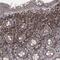 Serum Amyloid A Like 1 antibody, HPA039004, Atlas Antibodies, Immunohistochemistry frozen image 