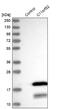 Chromosome 11 Open Reading Frame 52 antibody, NBP2-38409, Novus Biologicals, Western Blot image 