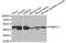 Proteasome 26S Subunit, Non-ATPase 13 antibody, A12485, ABclonal Technology, Western Blot image 