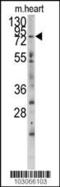 Myosin Light Chain Kinase 3 antibody, 63-312, ProSci, Western Blot image 