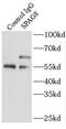 Sperm-associated antigen 8 antibody, FNab08146, FineTest, Immunoprecipitation image 