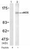Nitric Oxide Synthase 3 antibody, AP08055PU-N, Origene, Western Blot image 