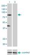 Ring Finger Protein 103 antibody, H00007844-M01, Novus Biologicals, Western Blot image 